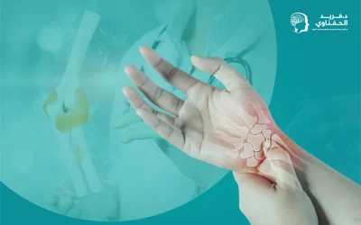 علاج التهاب المفاصل