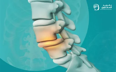 علاج تزحزح الفقرات 