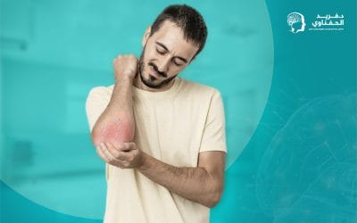 التهاب المفاصل الصدفي: ما هو؟ وكيف يُعالج؟