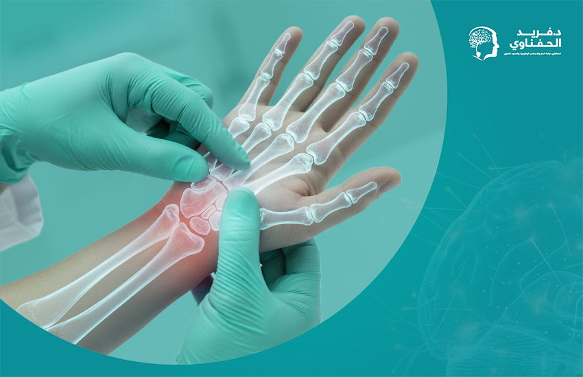 علاج متلازمة النفق الرسغي