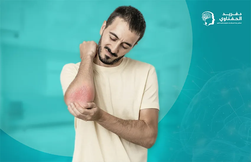 التهاب-المفاصل-الصدفي التهاب المفاصل الصدفي