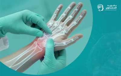 علاج متلازمة النفق الرسغي التدخل المبكر يُعيد إليك القوة والتحكم