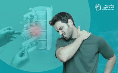 متى يكون التردد الحراري لعلاج الانزلاق الغضروفي إجراءً فعالًا؟