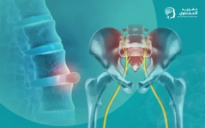 ما الفرق بين الانزلاق الغضروفي وعرق النسا؟