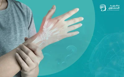 وجع أعصاب اليد | الأسباب وسُبُل التشخيص والعلاج